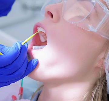Dental patient receiving fluoride treatment