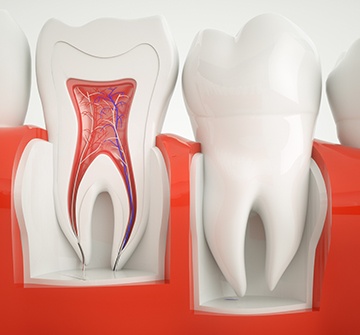 Animated inside of a healthy tooth showing area treated during root canal and pulp therapy